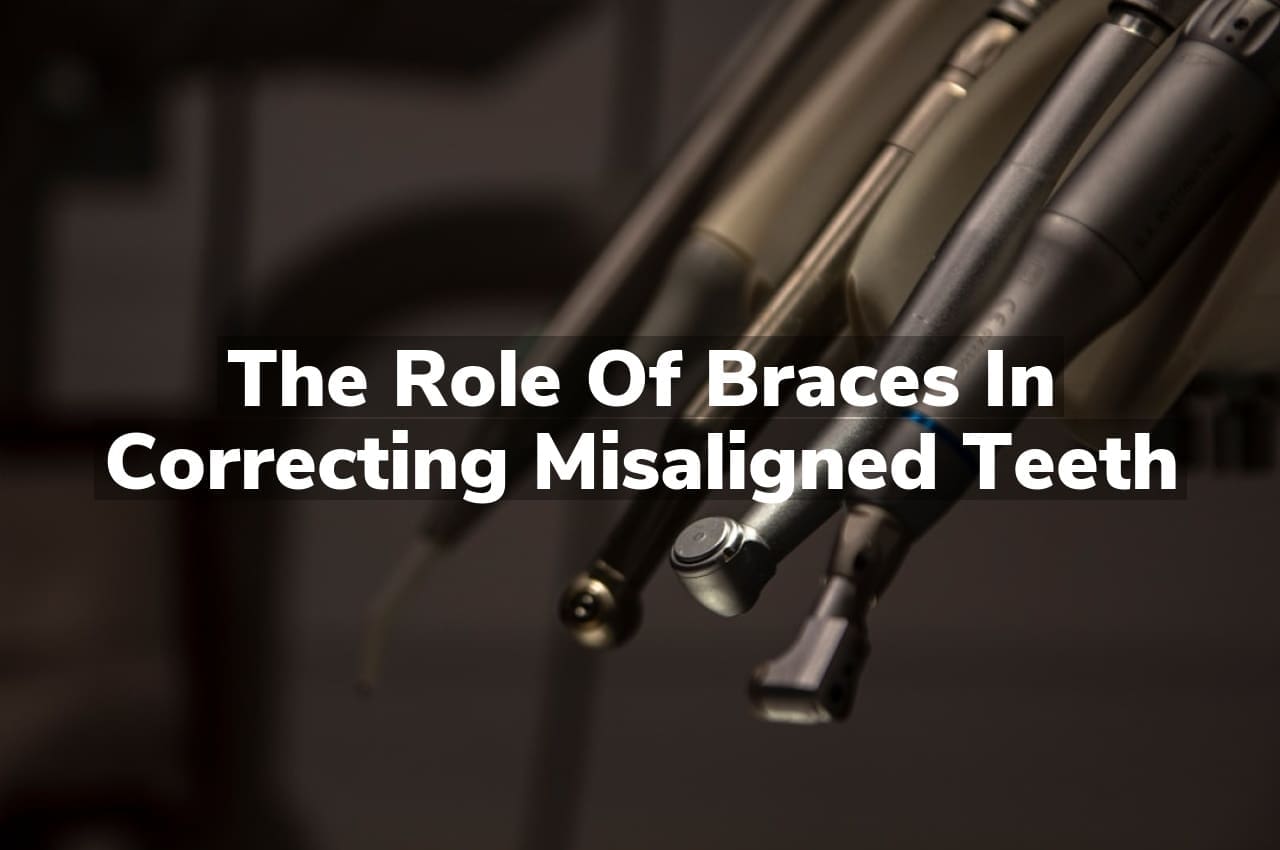 The Role of Braces in Correcting Misaligned Teeth