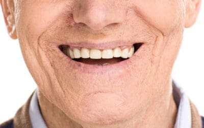 Upper Partial Dentures: What to Expect & How They Help